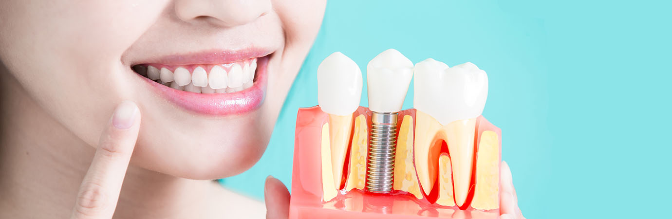 Implantologie Implantologie